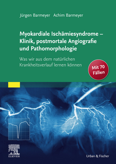 Die myokardialen Ischämiesyndrome - Klinik und postmortale Pathomorphologie main product photo