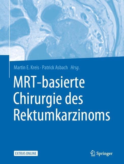 MRT-basierte Chirurgie des Rektumkarzinoms main product photo
