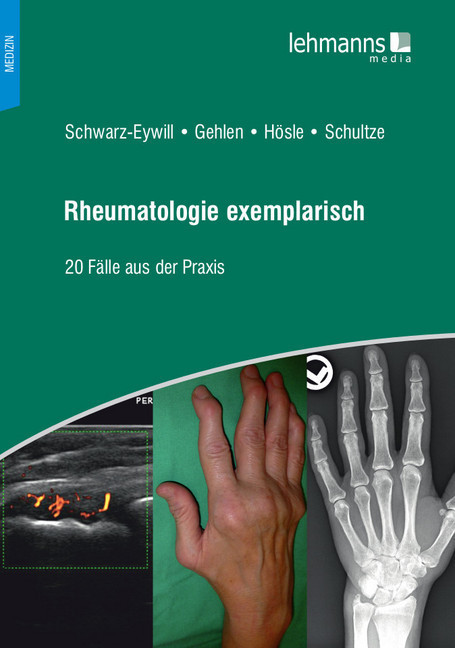 Rheumatologie exemplarisch main product photo