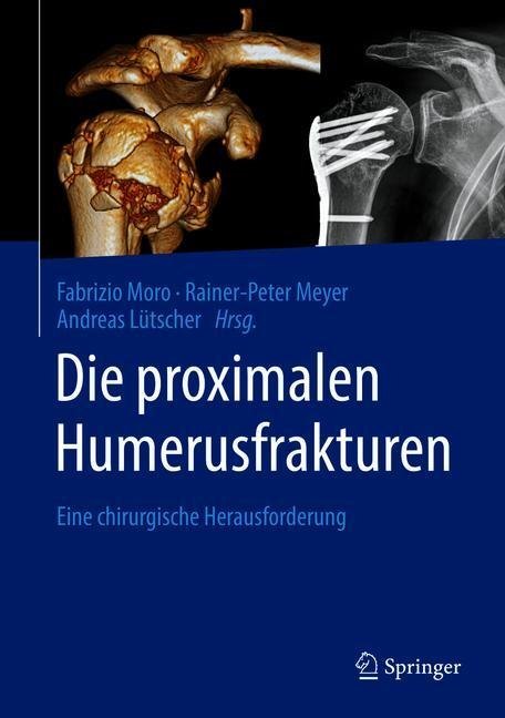 Die proximalen Humerusfrakturen main product photo
