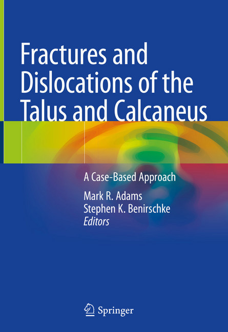 Fractures and Dislocations of the Talus and Calcaneus main product photo