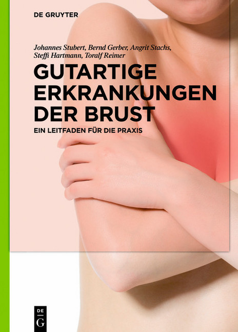 Gutartige Erkrankungen der Brust main product photo