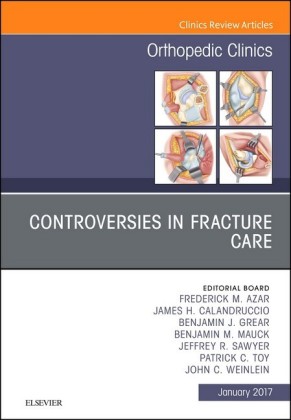 Controversies in Fracture Care, An Issue of Orthopedic Clinics, E-Book