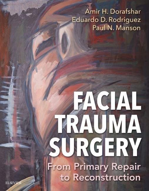 Facial Trauma Surgery E-Book main product photo