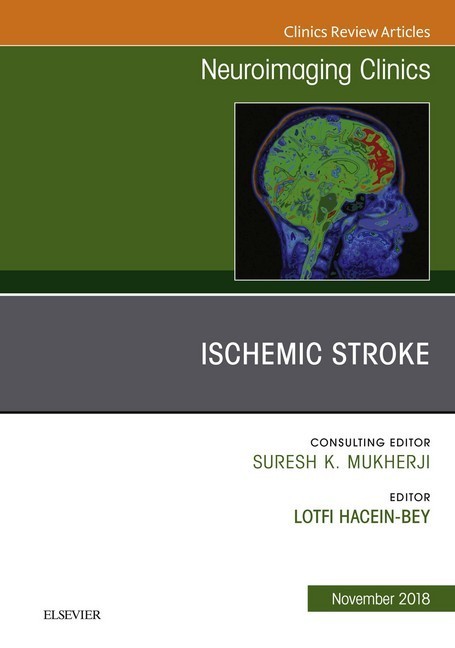 Ischemic Stroke, An Issue of Neuroimaging Clinics of North America E-Book main product photo