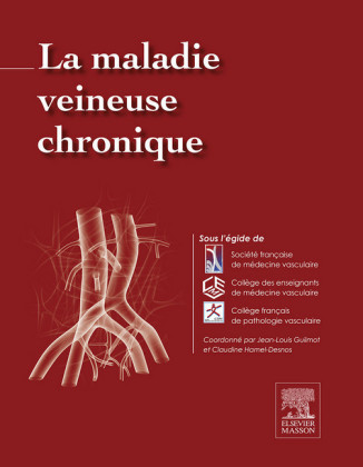 La maladie veineuse chronique