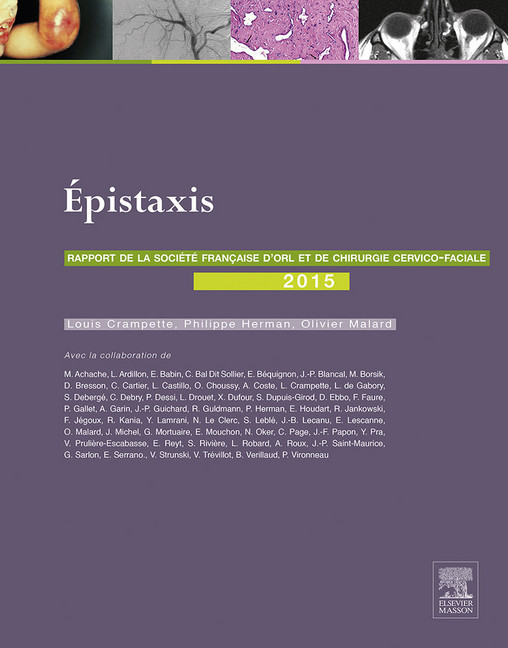 Les épistaxis main product photo