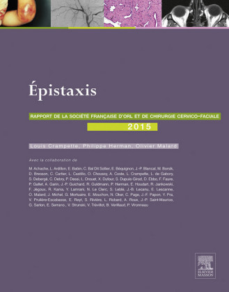 Les épistaxis