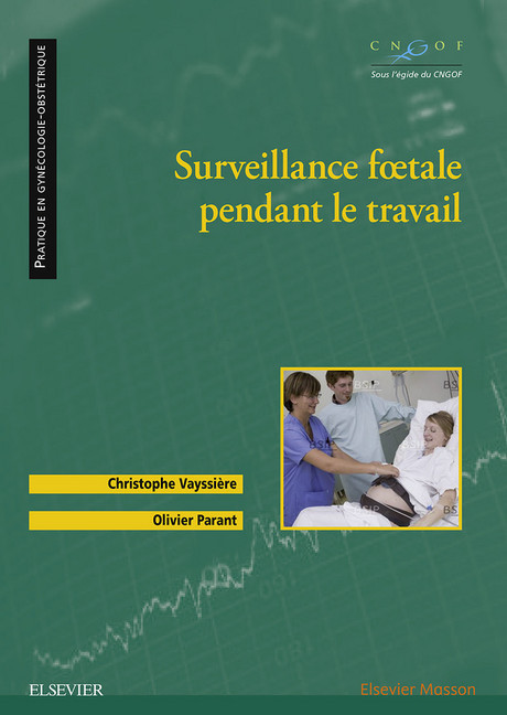 Surveillance foetale pendant le travail main product photo