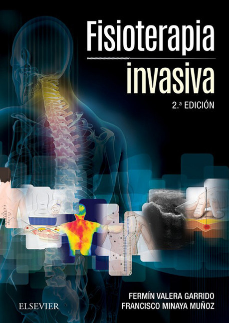 Fisioterapia invasiva main product photo