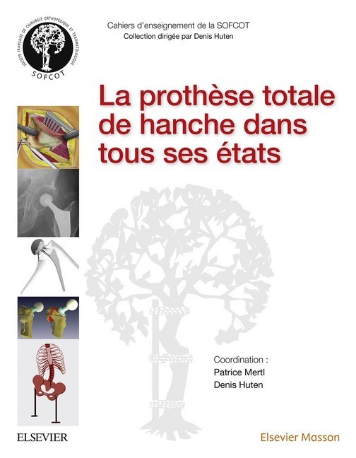 La prothèse totale de hanche dans tous ses états main product photo