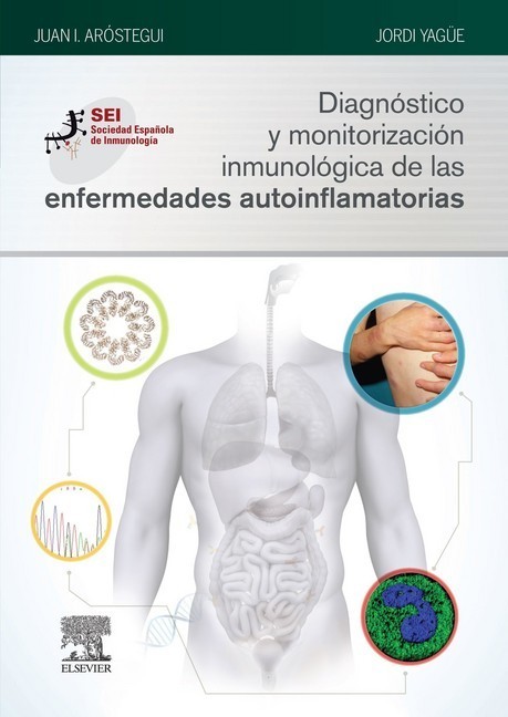 Diagnóstico y monitorización inmunológica de las enfermedades autoinflamatorias main product photo