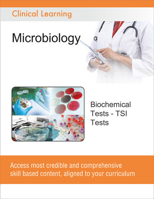Biochemical Tests - TSI Tests main product photo