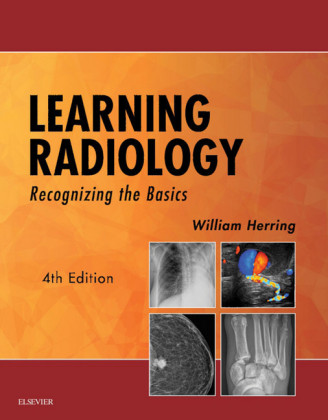 Learning Radiology E-Book