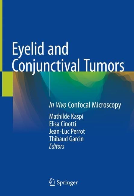 Eyelid and Conjunctival Tumors main product photo