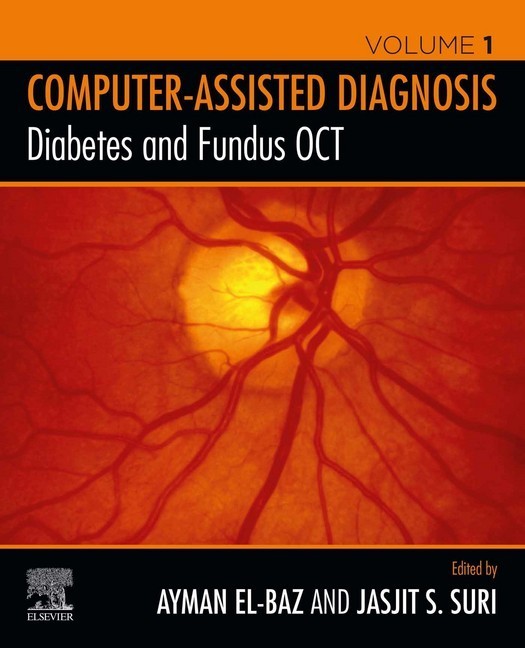 Diabetes and Fundus OCT main product photo
