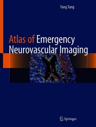 Atlas of Emergency Neurovascular Imaging