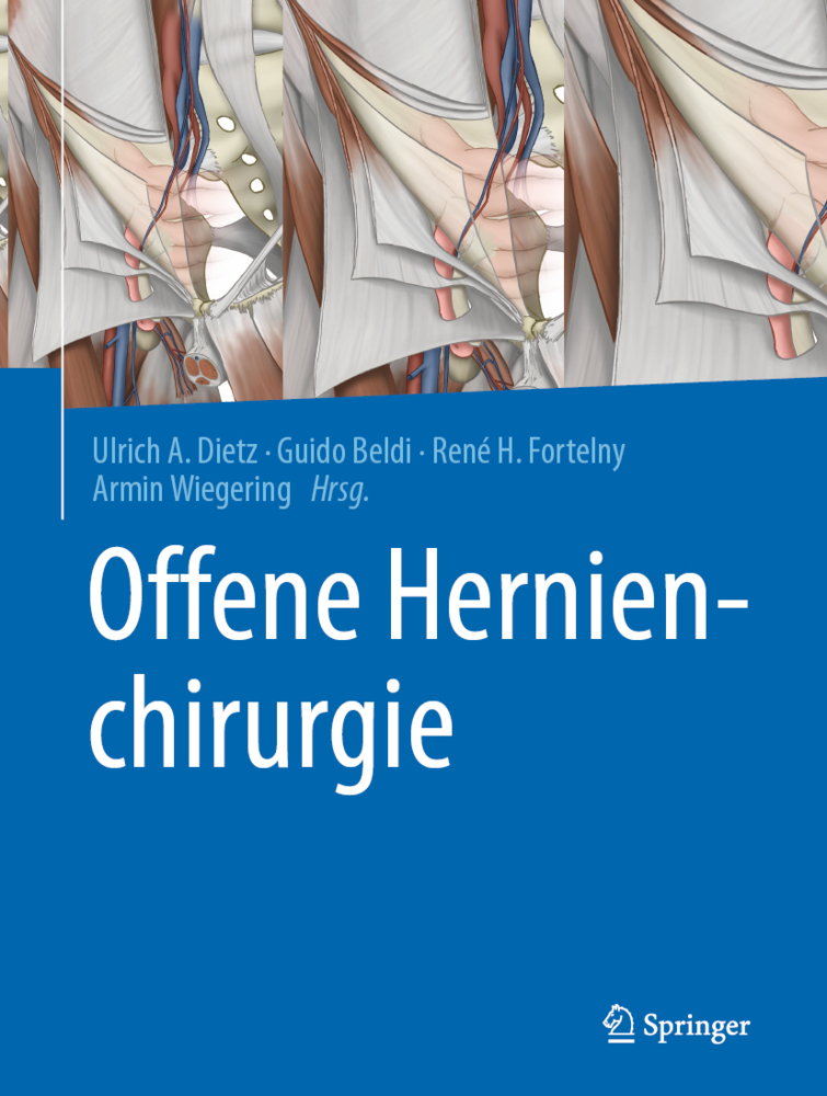 Offene Hernienchirurgie main product photo