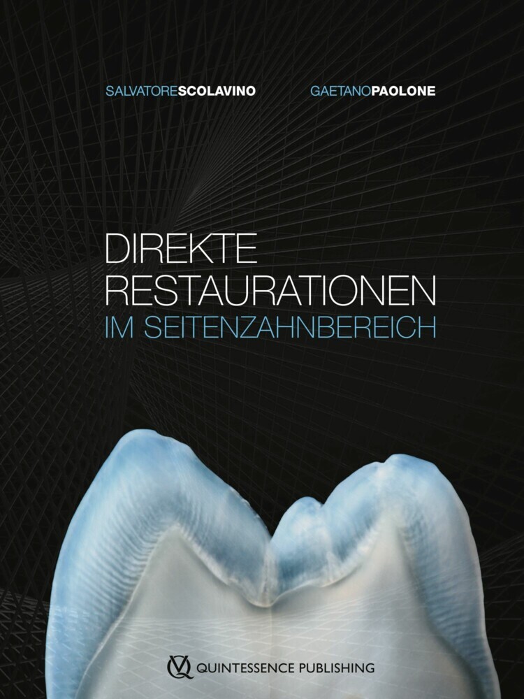 Direkte Restaurationen im Seitenzahnbereich main product photo