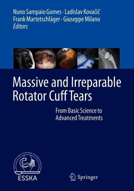 Massive and Irreparable Rotator Cuff Tears main product photo