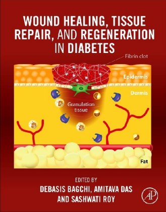 Wound Healing, Tissue Repair, and Regeneration in Diabetes