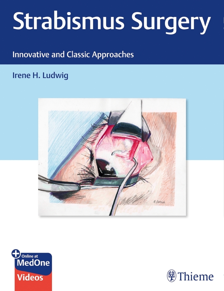 Strabismus Surgery main product photo