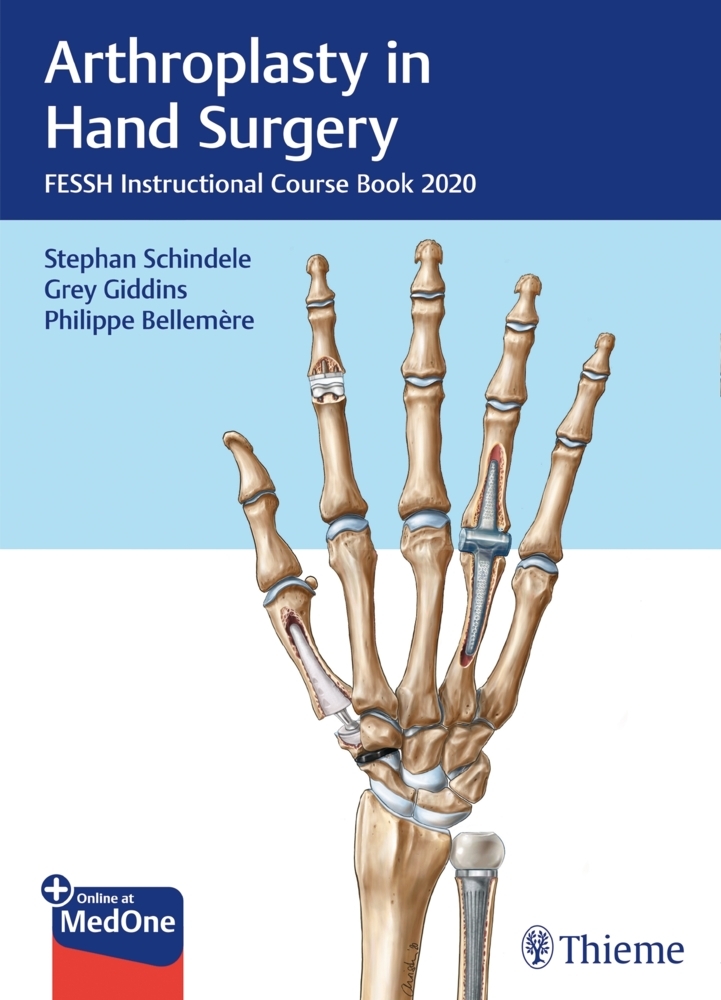 Arthroplasty in Hand Surgery main product photo