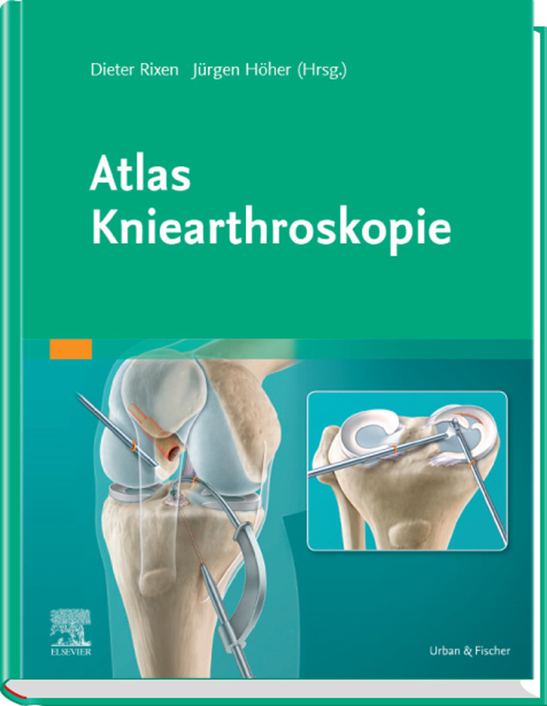 Atlas Kniearthroskopie main product photo