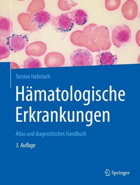 Hämatologische Erkrankungen main product photo