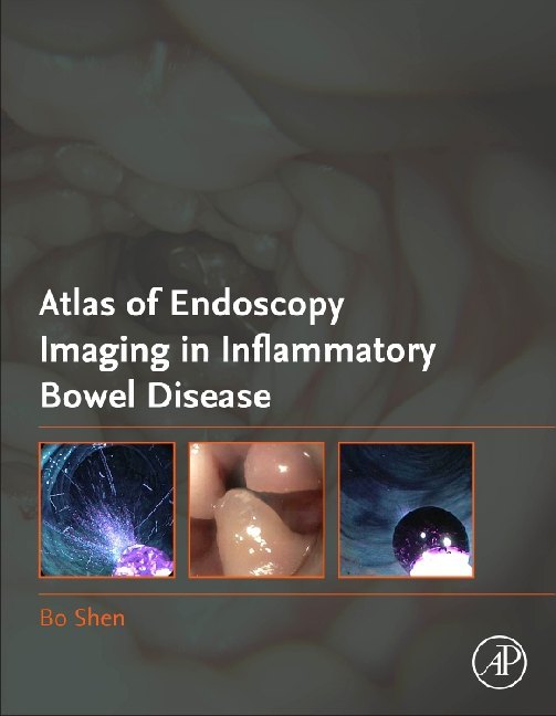 Atlas of Endoscopy Imaging in Inflammatory Bowel Disease main product photo