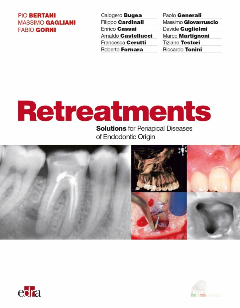 Retreatment main product photo