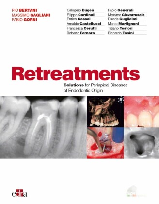 Retreatment