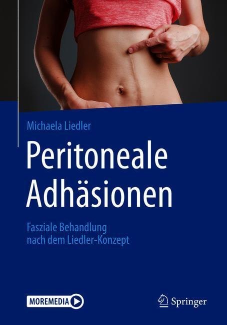 Peritoneale Adhäsionen main product photo