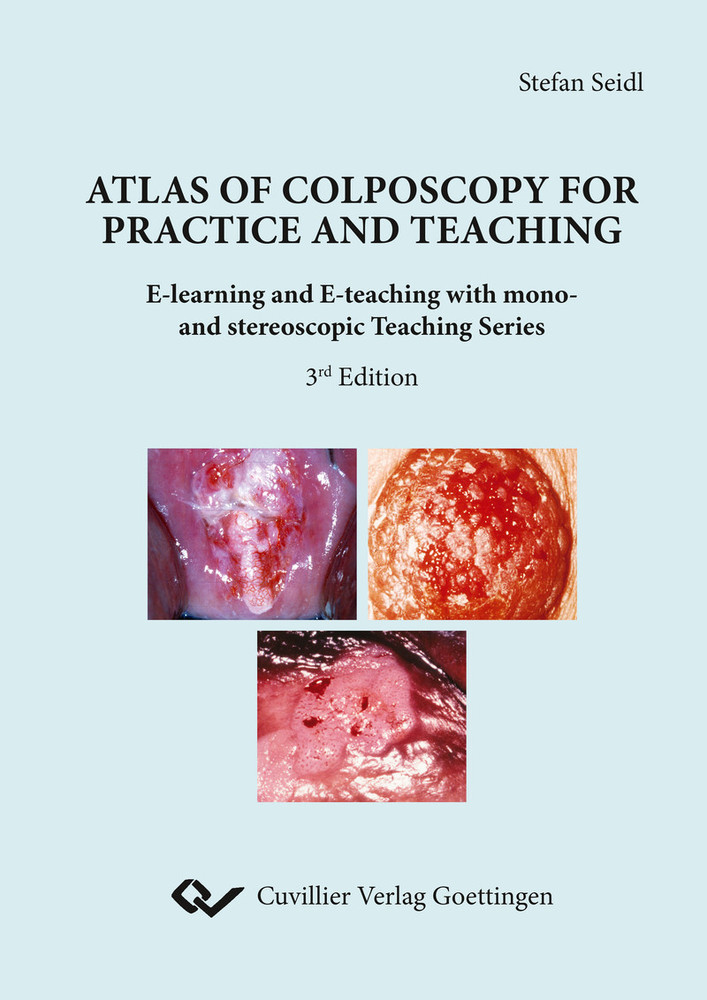 Atlas of Colposcopy for Practice and Teaching main product photo