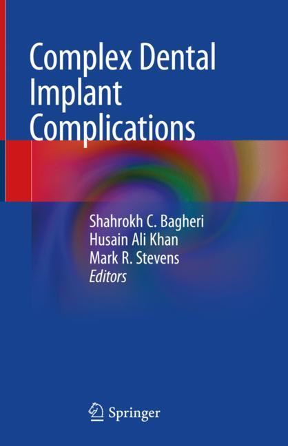 Complex Dental Implant Complications main product photo