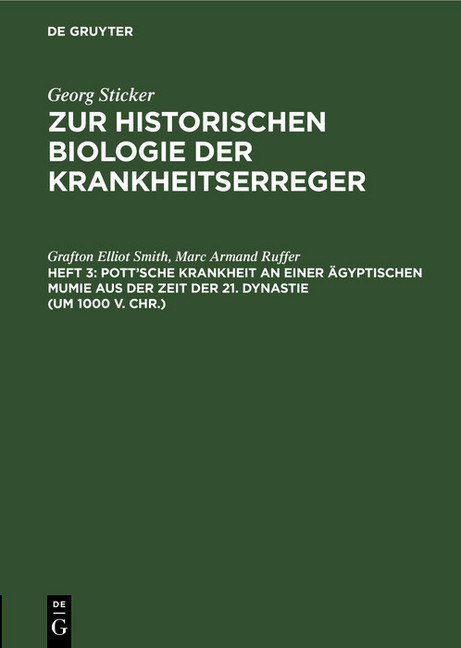 Pott'sche Krankheit an einer ägyptischen Mumie aus der Zeit der 21. Dynastie (um 1000 v. Chr.) main product photo