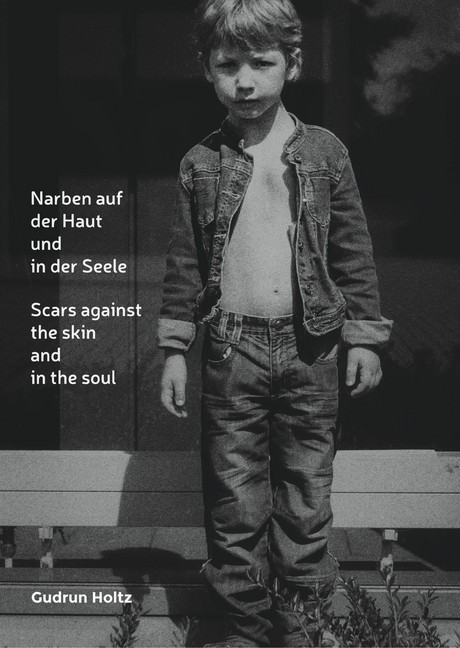 Narben auf der Haut und in der Seele main product photo