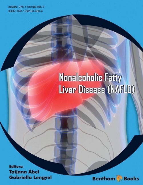 Nonalcoholic Fatty Liver Disease NAFLD main product photo
