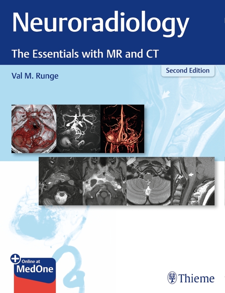 Neuroradiology main product photo