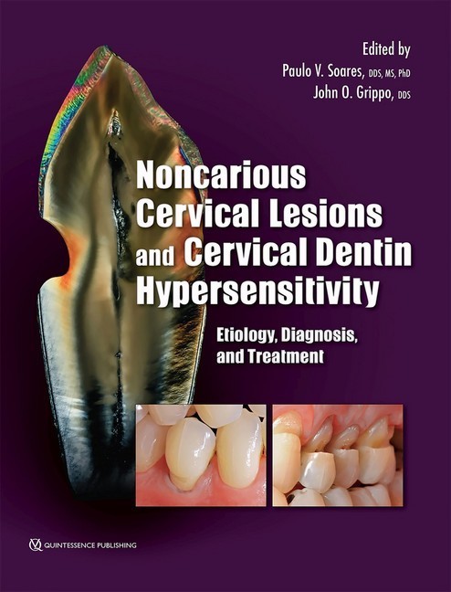 Noncarious Cervical Lesions and Cervical Dentin Hypersensitivity; . main product photo