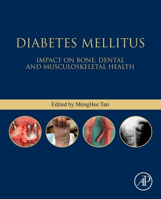 Diabetes Mellitus; . main product photo