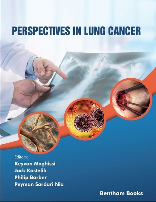 Perspectives in Lung Cancer main product photo