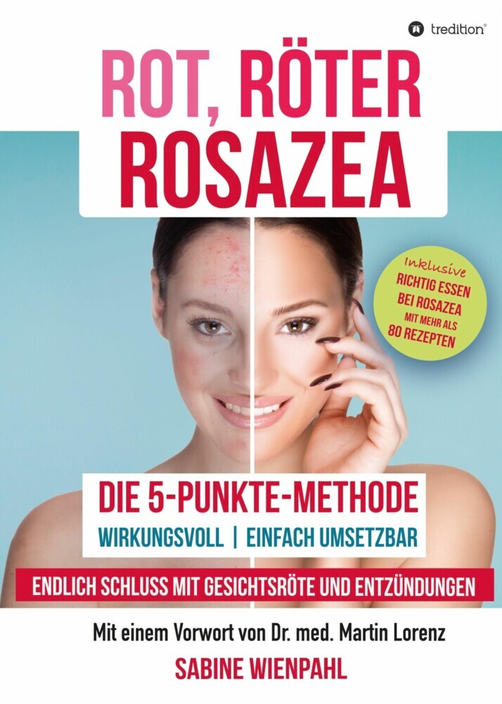 ROT RÖTER ROSAZEA main product photo