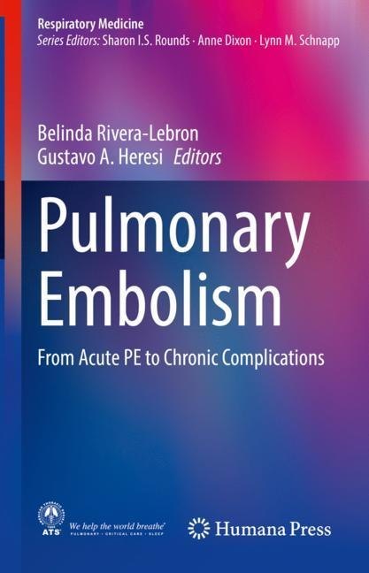Pulmonary Embolism main product photo