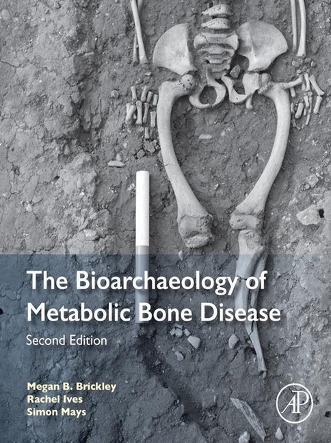 The Bioarchaeology of Metabolic Bone Disease main product photo