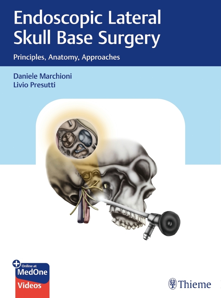 Endoscopic Lateral Skull Base Surgery main product photo