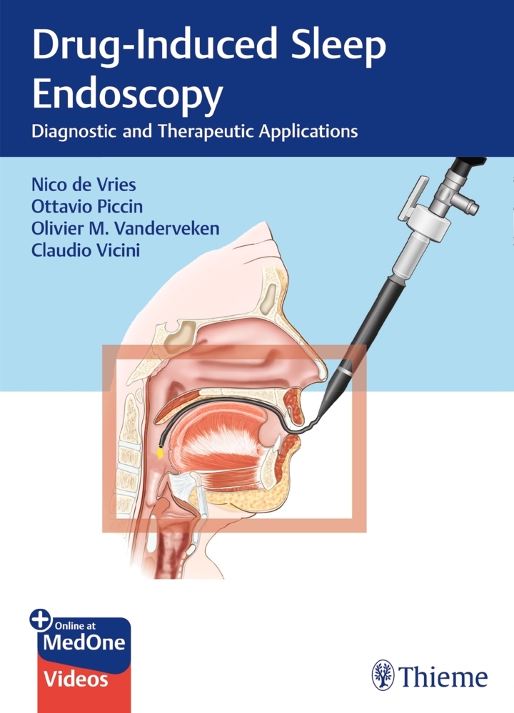 Drug-Induced Sleep Endoscopy main product photo