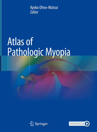 Atlas of Pathologic Myopia