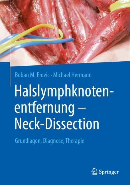 Halslymphknotenentfernung - Neck-Dissection main product photo