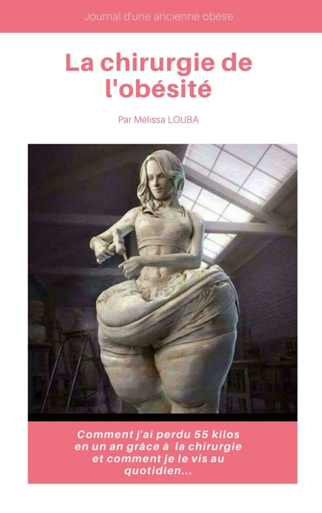 La Chirurgie de l'Obésité main product photo